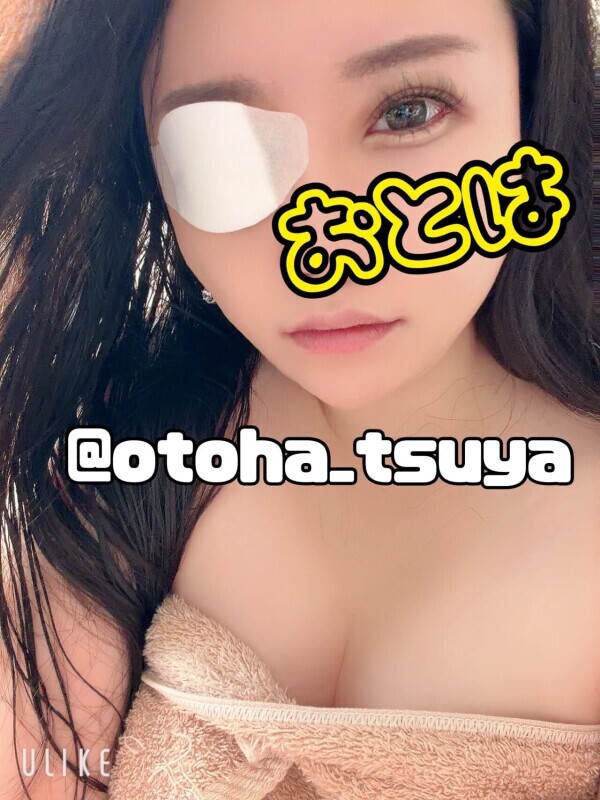 ものもらい出来たため眼帯しています