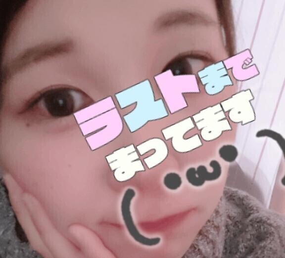レア