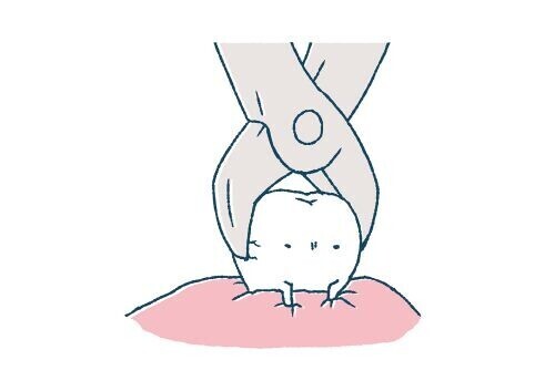 抜歯ﾘﾀｰﾝｽﾞ🦷