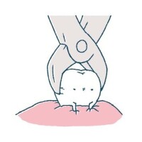 抜歯ﾘﾀｰﾝｽﾞ🦷