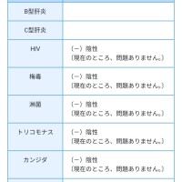 ありす