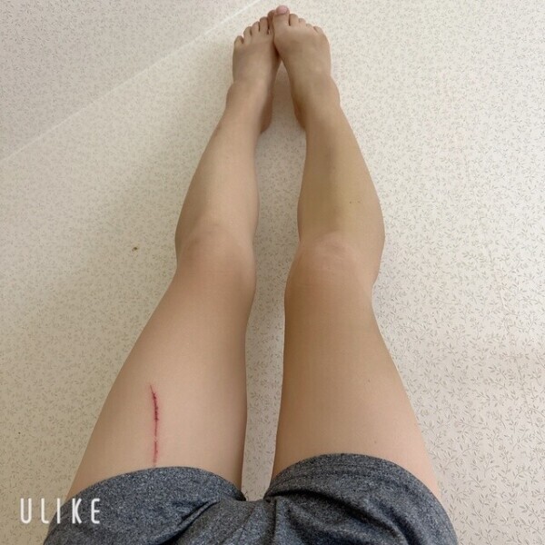 傷、、、