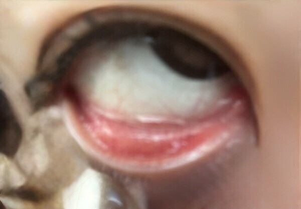 🦟🦟 🦟🦟 🦟🦟