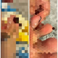 ガビガビガビーン( っ -᷄ ,-᷅)╮ =͟͟͞͞🦠