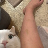 大根足