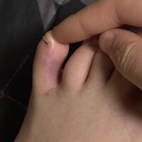 ポンコツにこちゃんの災難