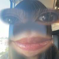 あごニキビって乾燥が原因らしい、ちゃんと保湿します。。