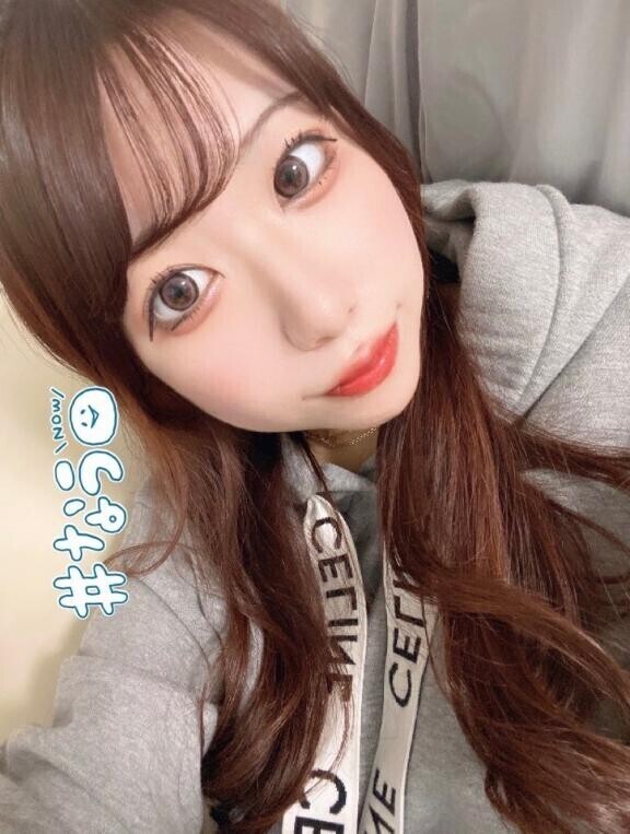 ?急遽?