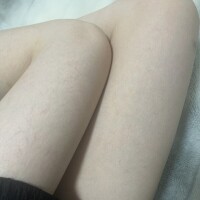 もも