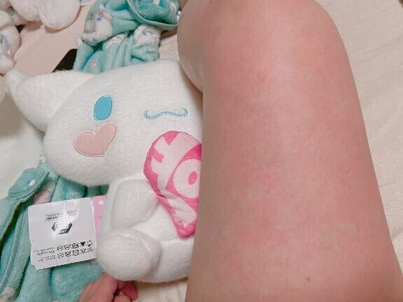 お風呂あつくしすぎてゆでだこ?