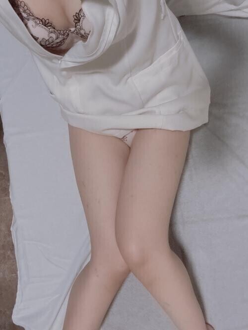 レア