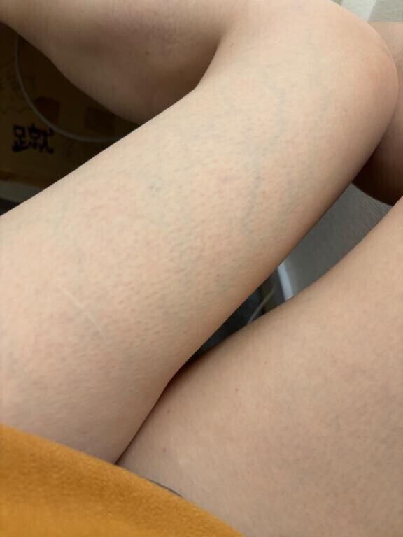 アチ〜い