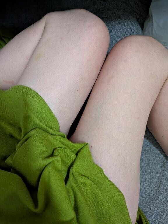 |ω•๑`)ㄘらり