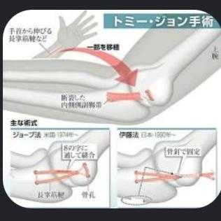 10.2   トニー　10.3   トミー
