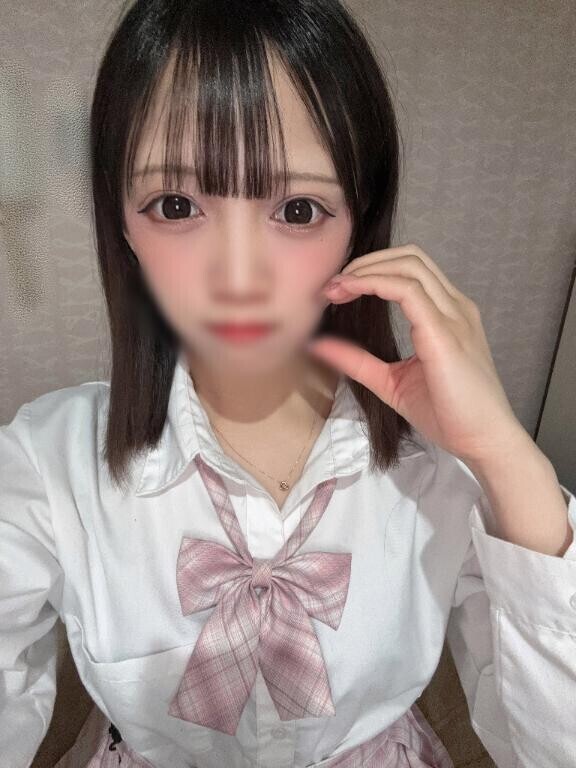 ?右目の二重幅が三重になって治らない
