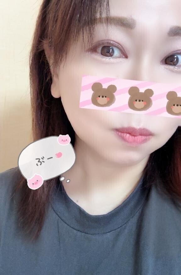 受付開始