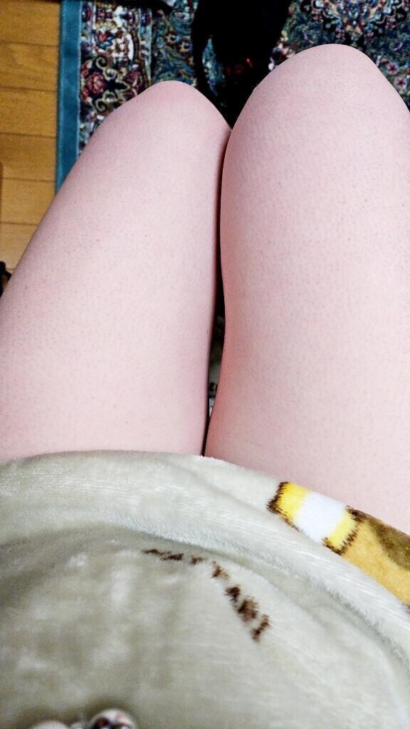 急ですが