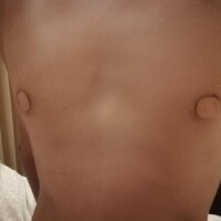 乳首開発
